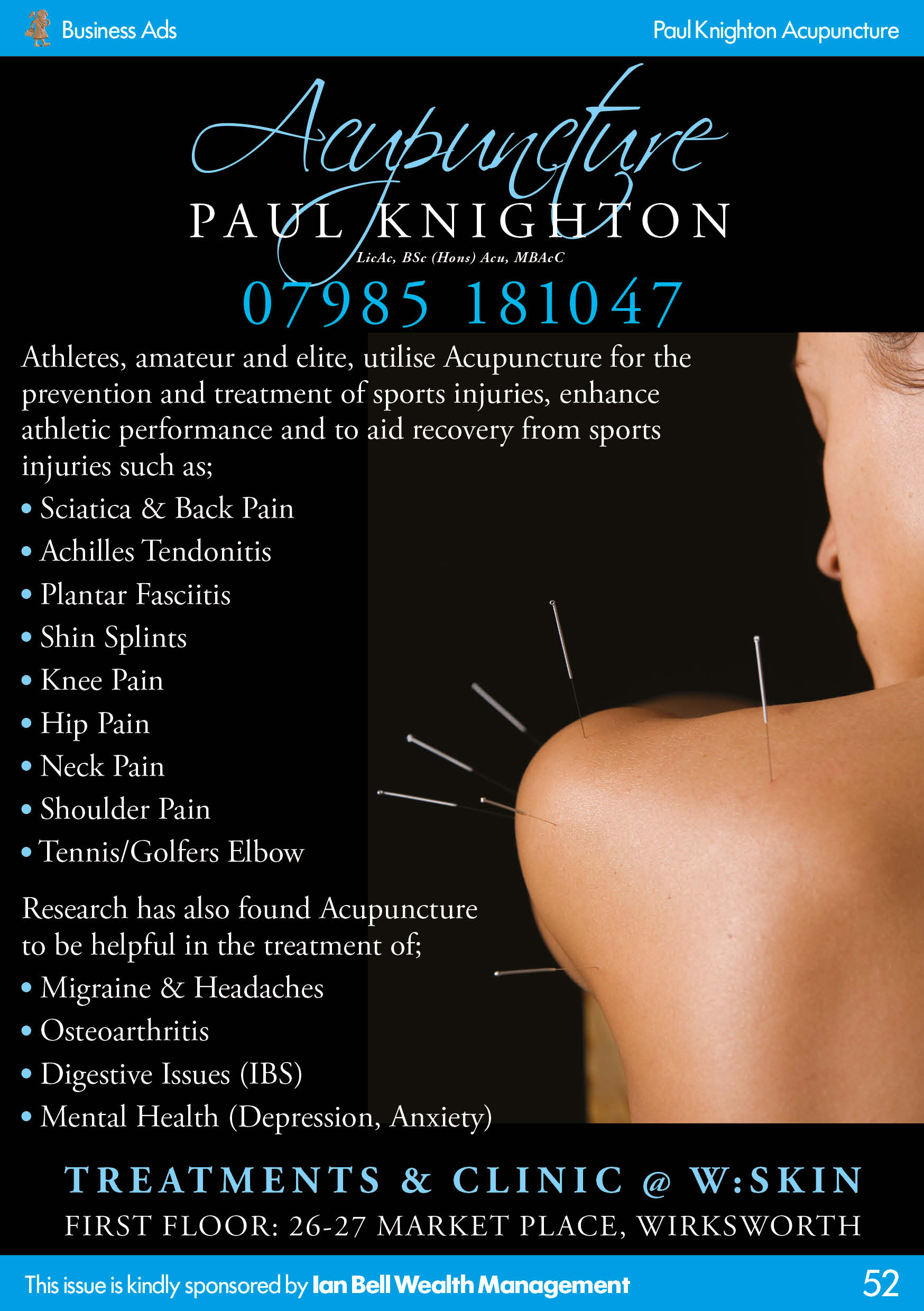 Acupuncture Paul Knighton